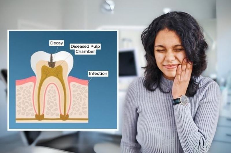 Root Canal Treatment